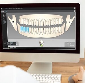 orthoselect